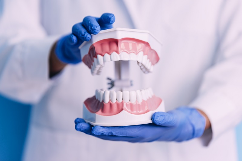 Dental model of the jaw.
