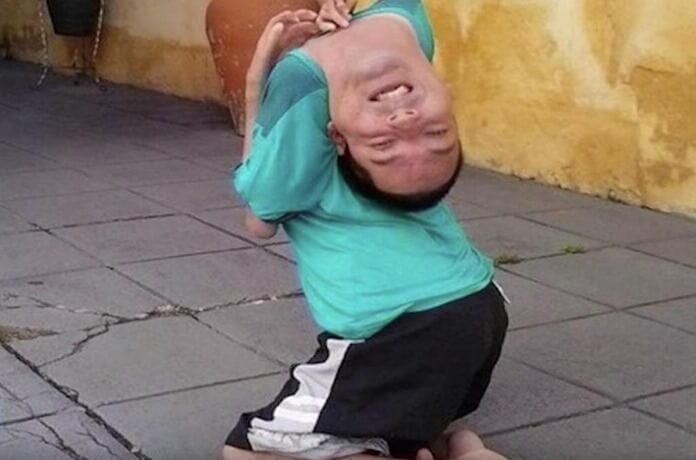 axmvhpzl